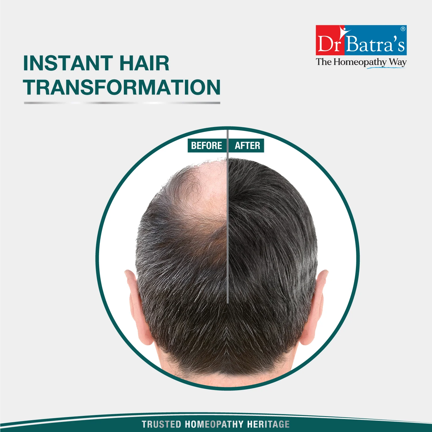 Instant Hair Natural keratin Hair Building Fibre - Black - Image 7