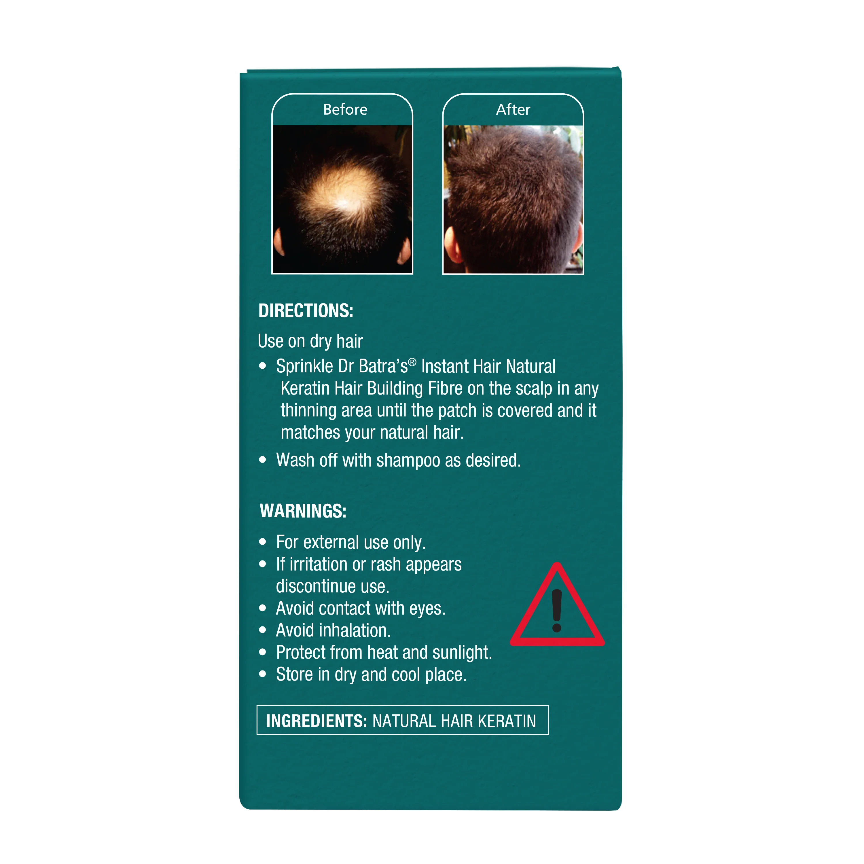 Instant Hair Natural Hair Building Fibre – Dark Brown - Image 4