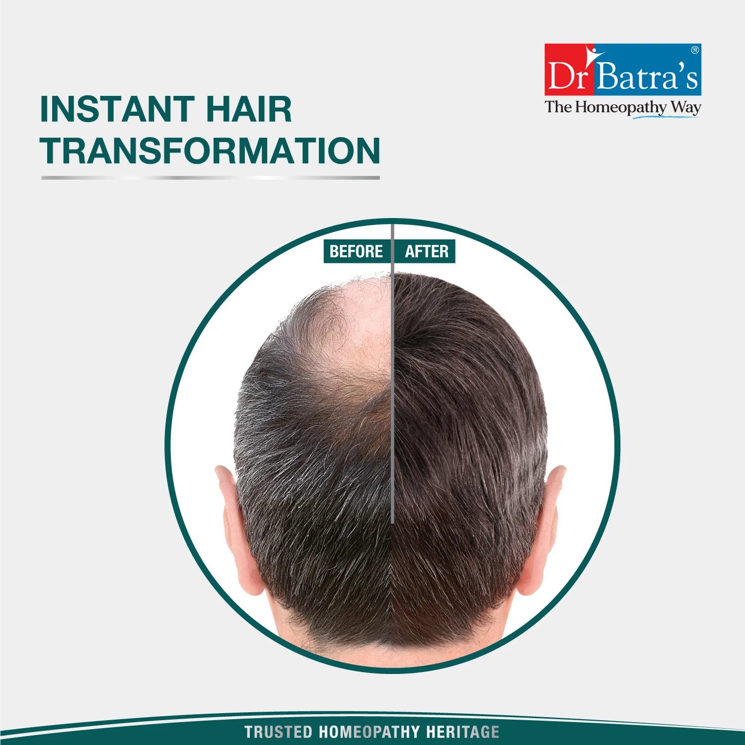Instant Hair Natural Hair Building Fibre – Dark Brown - Image 6